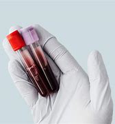 Image result for Waiting Blood Test Meme