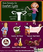 Image result for ovarian cyst treatment