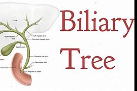 Image result for The Biliary Tree