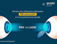Image result for PRK vs Lasik