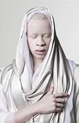 Image result for Albino People