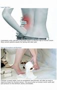 Image result for Ovarian Cancer and Back Pain