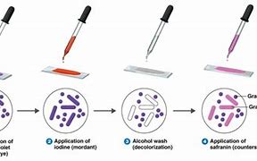 Image result for Gram Stain Process