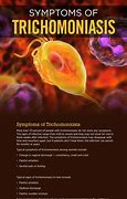 Image result for Trichomoniasis Signs and Symptoms