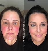 Image result for Skin Tone Glow Up