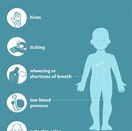Image result for Anaphylactic Shock Signs and Symptoms
