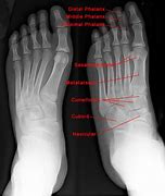 Image result for Normal Foot X-ray