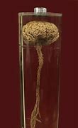 Image result for Preserved Human Brain