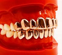 Image result for Rose Gold Grill