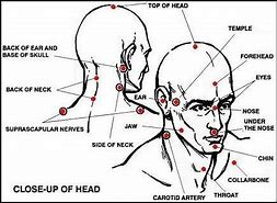 Image result for Martial Arts Pressure Points