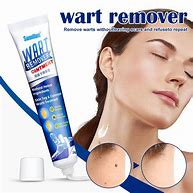 Image result for Cream for Warts Removal