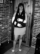 Image result for Girl with Broken Arm