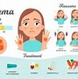 Image result for Eczema and Psoriasis