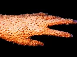 Image result for Trypophobia Disease Fingers