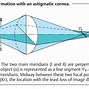 Image result for Cylindrical Lenses for Astigmatism