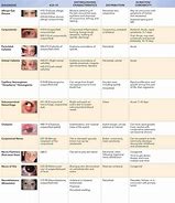 Image result for Anicteric Sclera
