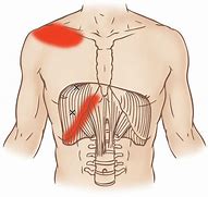 Image result for Diaphragm Muscle Pain