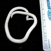 Image result for lumbricoides