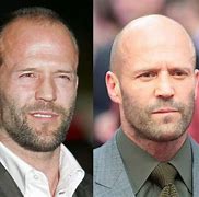 Image result for Jason Statham Hair Loss