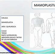 Image result for asipsia