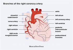 Image result for RCA Heart