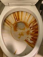 Image result for How to Clean Toilet Bowl Stains