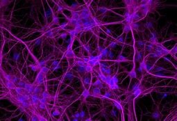 Image result for Neurons in Bovine Brain