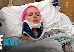 Image result for Jeffree Star Car Accident