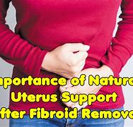 Image result for Fibroids Look Like