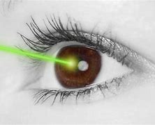 Image result for Refractive Eye Lasers