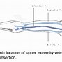 Image result for Midline Catheter Placement