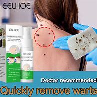 Image result for Wart Remover On Mole