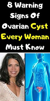 Image result for 12 Cm Cyst On Ovary