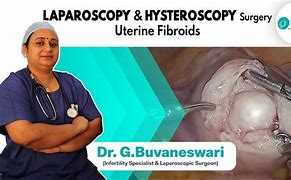 Image result for Uterine Fibroid Removal Surgery