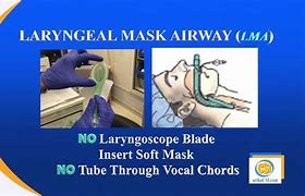 Image result for Rapid Recovery From Anesthesia