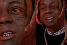 Image result for Lil Wayne Swollen Face