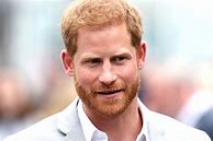 Image result for Prince Harry Hairline
