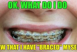 Image result for Braces Girl Meme