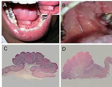 Image result for Viral Papilloma Dogs
