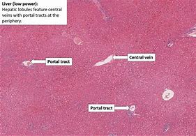 Image result for Normal Liver Pathology