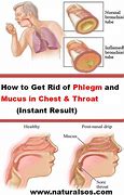 Image result for Chest Congestion Phlegm Color
