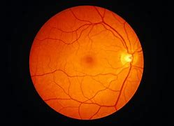 Image result for Basics of Fundus Retina Drawing