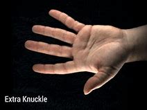 Image result for Knuckles On Hand