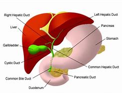 Image result for Internalized Biliary Drain