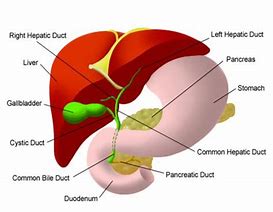 Image result for External Biliary Drain