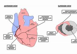 Image result for RCA Heart