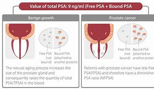 Image result for PSA and Prostate Cancer