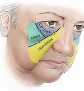 Image result for Smas Face Anatomy