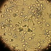 Image result for Urine Chlamydia Cells Under Microscope