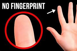 Image result for People with No Fingerprints